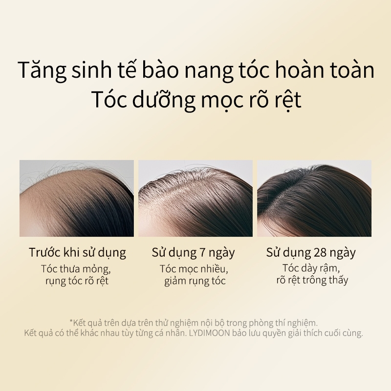 Tinh dầu mọc tóc Xịt mọc tóc Serum chống rụng tóc 30ml Thành phần thảo dược giúp tóc mọc hiệu quả