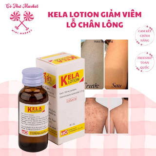KELA LOTION THÁI LAN, Viêm nang lông,viêm lỗ chân lông 30ml, 60ml - CÔ THƯ MARKET