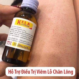 KELA LOTION THÁI LAN, Viêm nang lông,viêm lỗ chân lông 30ml, 60ml - CÔ THƯ MARKET