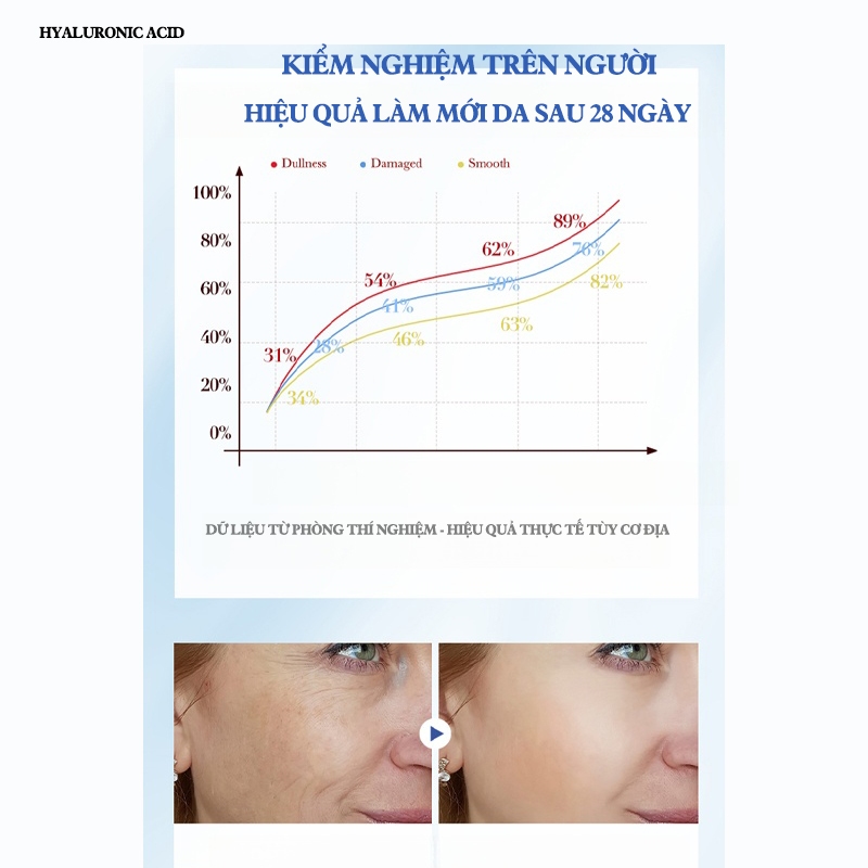 【MUA 1 TẶNG 4】Serum 5% Hyaluronic Acid + Ceramide 100ml, Cấp ẩm khóa ẩm sâu, ngăn ngừa nếp nhăn khô - CHÍNH HÃNG
