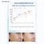 Serum Collagen + HA Hỗ Trợ Làm Sáng & Cải Thiện Dấu Hiệu Lão Hóa - Dưỡng Ẩm Sâu SADÖER CHÍNH HÃNG