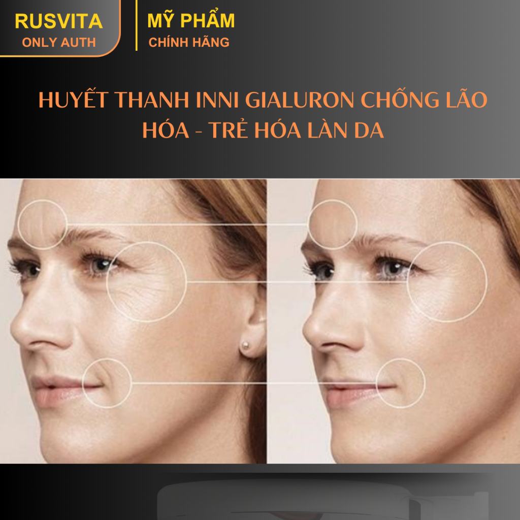 [Huyết thanh INNO GIALURON chống lão hóa nhập khẩu Nga chính hãng] Làm mờ nếp nhăn,dưỡng da, bổ sung Collagen