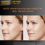 Làm mờ nếp nhăn,dưỡng da, bổ sung Collagen