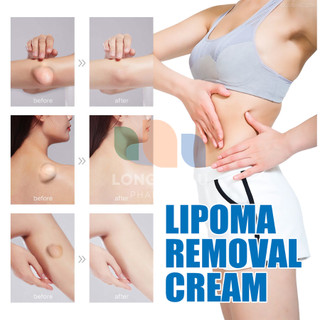 Kem Bôi Tan U Mỡ U Bã Đậu SUMIFUN LIPOMA Mỹ Giúp Tan Khối U Mỡ U Bã Đậu Hiệu Quả Giảm Sưng Đau