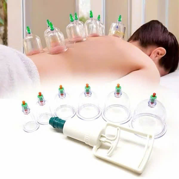 Bộ Dụng Cụ Giác Hơi 12 Ống Không Dùng Lửa Kèm Ống Dây Dài