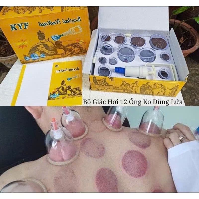 Bộ Dụng Cụ Giác Hơi 12 Ống Không Dùng Lửa Kèm Ống Dây Dài