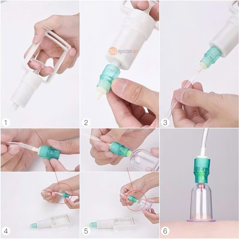 Bộ Dụng Cụ Giác Hơi 12 Ống Không Dùng Lửa Kèm Ống Dây Dài
