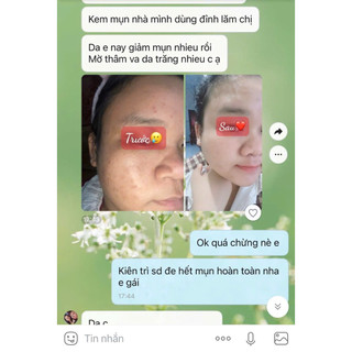 KEM MỤN X5 ( COMBO 3 HỘP )