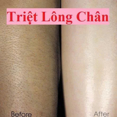 Mỡ trăn N STORE triệt lông, mỡ trăn N STORE wax lông gia nhiệt, dương mềm da, lành vết bỏng, giảm thâm  Chính Hãng