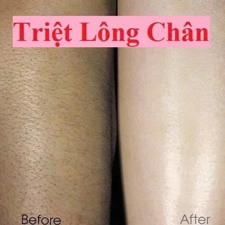 Mỡ trăn nguyên chất N'store, triệt lông, mờ rạn da, lành vết bỏng,lành nứt gót chân nước ăn chân hiệu quả -Chính hãng