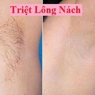 Mỡ trăn nguyên chất N'store, triệt lông, mờ rạn da, lành vết bỏng,lành nứt gót chân nước ăn chân hiệu quả -Chính hãng