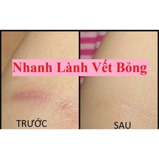 Mỡ trăn nguyên chất N'store, triệt lông, mờ rạn da, lành vết bỏng,lành nứt gót chân nước ăn chân hiệu quả -Chính hãng
