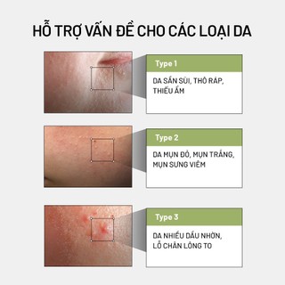 Tinh Chất Rau Má Arocell Cica Repair Panthenol Ampoule 40ml Phục Hồi Da, Làm Dịu Da Nhạy Cảm, Cấp Ẩm