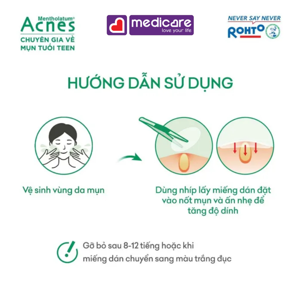 Miếng dán mụn ACNES clear patch giúp giảm mụn sưng