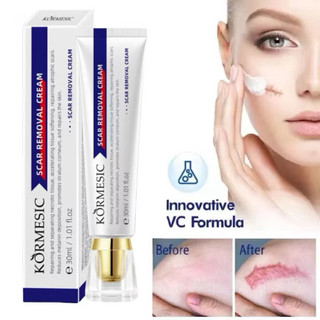 Kem Mờ Sẹo Kormesic Chính Hãng Hỗ Trợ Giảm Sẹo Mụn Sẹo Bỏng Sẹo Thủy Đậu, Phục Hồi Da Mềm Mịn 30ml