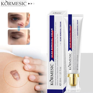 Kem Mờ Sẹo Kormesic Chính Hãng Hỗ Trợ Giảm Sẹo Mụn Sẹo Bỏng Sẹo Thủy Đậu, Phục Hồi Da Mềm Mịn 30ml