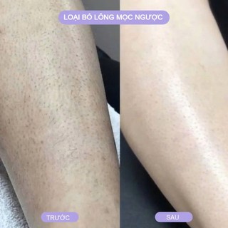 Mua 1 Tặng 1 - Đá Tẩy Lông và Tế Bào Chết Body Chân Tay Bleame, Nhẹ Nhàng Dễ Dàng Tiết Kiệm