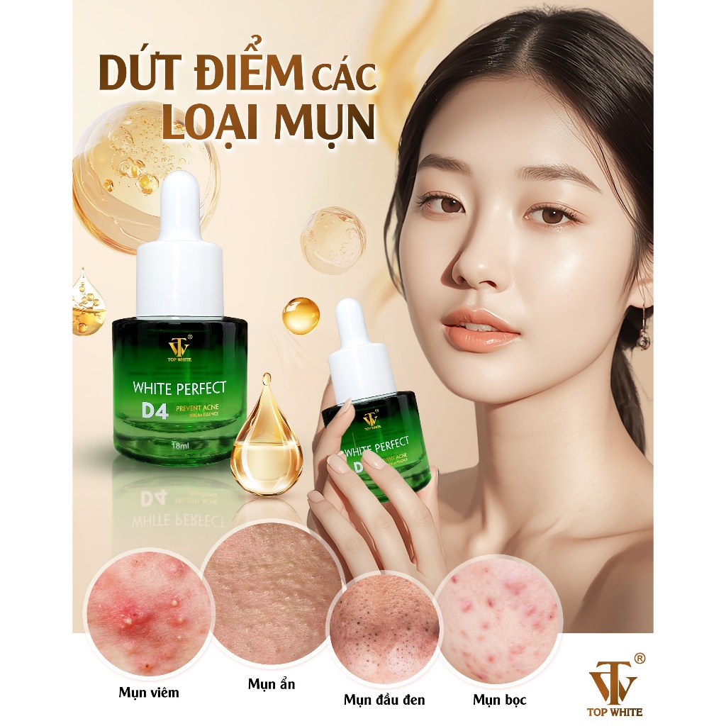 Serum giảm mụn Top White- White Perfect D4 Prevent Acne Serum Essence