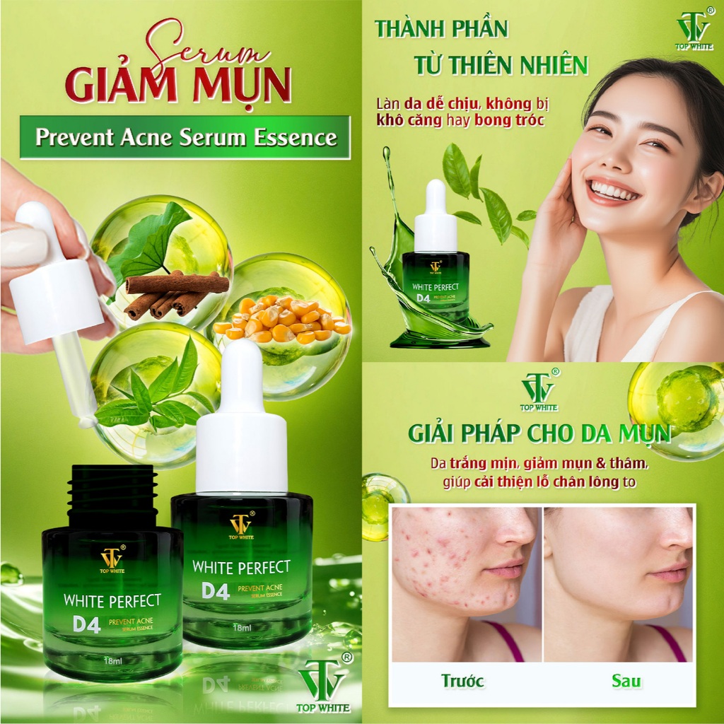 Serum giảm mụn Top White- White Perfect D4 Prevent Acne Serum Essence