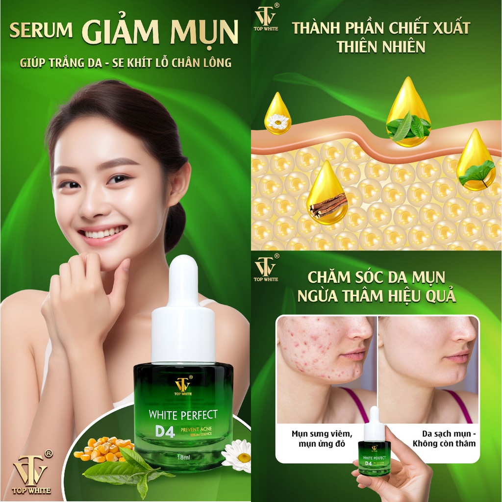 Serum giảm mụn Top White- White Perfect D4 Prevent Acne Serum Essence