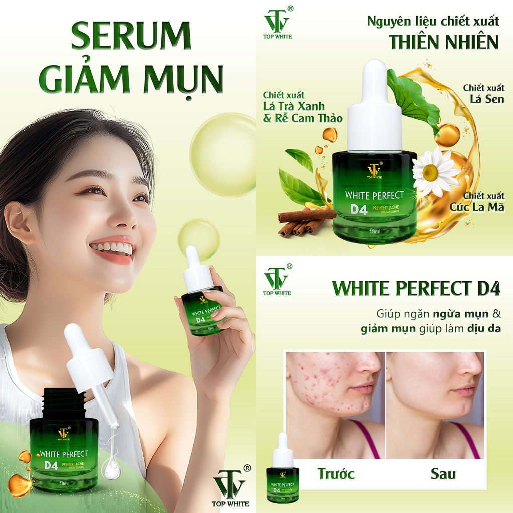 Serum giảm mụn Top White- White Perfect D4 Prevent Acne Serum Essence