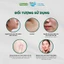 HA cấp ẩm sâu, dưỡng ẩm dạng xịt Freeskin - Novocare cho da dầu mụn, làm dịu, dưỡng da căng bóng, dưỡng ẩm trước makeup