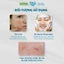 Set 2 Bọt rửa mặt cho da dầu mụn Freeskin - Novocare Làm sạch sâu, hỗ trợ giảm mụn và bã nhờn, không khô căng da 120ml