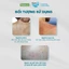 Xịt mờ thâm Freeskin - Novocare Mờ thâm mụn lưng, mụn cơ thể, viêm nang lông, giảm thâm sạm, dưỡng sáng 80ml