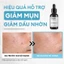 Serum Calm giảm mụn kiềm dầu cho nam BHA + phức hợp thảo mộc Men Stay Simplicity 10ml/30ml