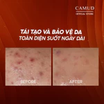 Combo kem dưỡng Phytocin V2 Hybrid Cream & chống nắng FINISH LOTION SPF50+/PA+++ Pharmesthetic CAMUD — ảnh 7