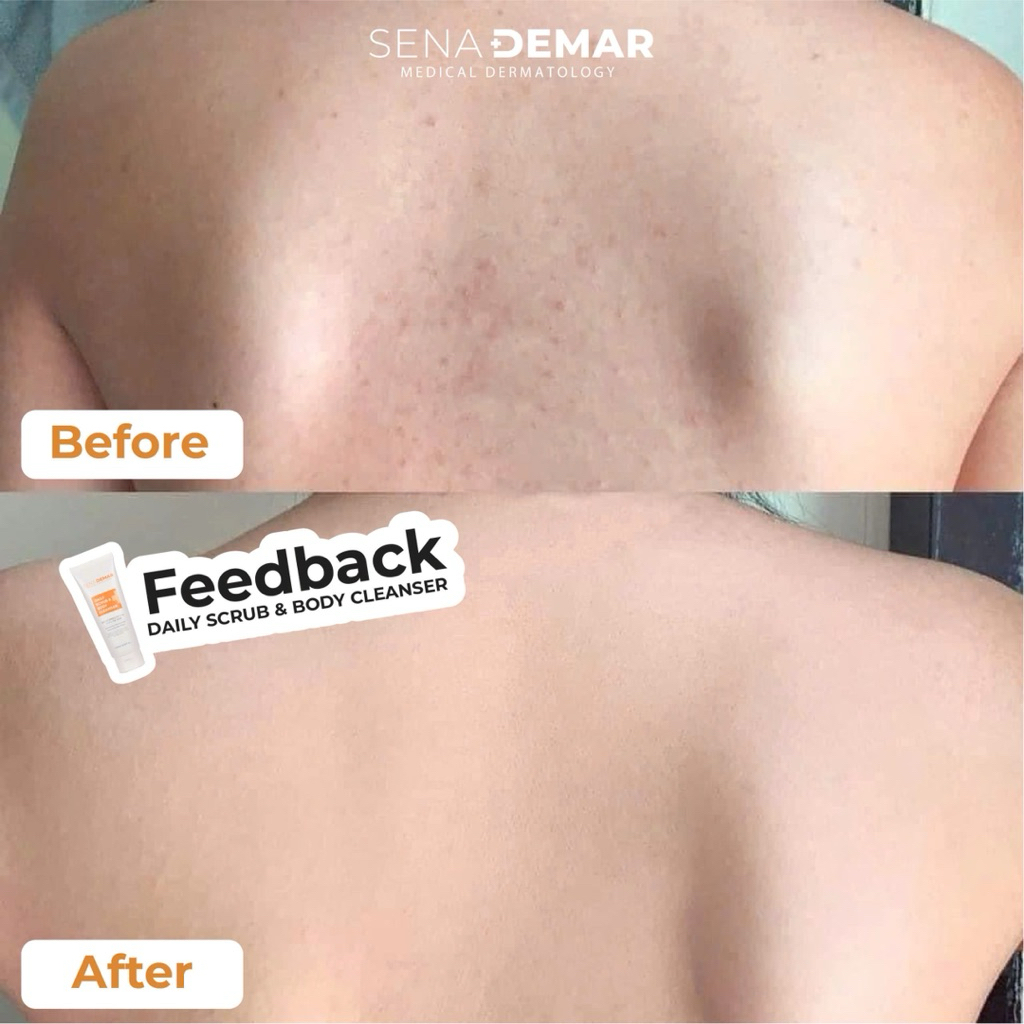 Sữa tắm SENA DEMAR DAILY SCRUB & BODY CLEANSER 200ml hạn 2028 muối tắm senademar IS451