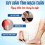 kem giảm giãn tĩnh mạch Nhật Bản. giúp co mạch máu nhanh chóng. Giảm gân xanh hiệu quả