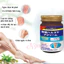 kem giảm giãn tĩnh mạch Nhật Bản. giúp co mạch máu nhanh chóng. Giảm gân xanh hiệu quả