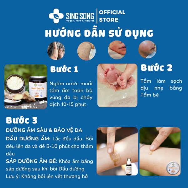 Sáp Dưỡng Ẩm Singsong, 100% không Corticoid, hỗ trợ Viêm Da Cơ Địa, Vảy Nến, Eczema, Lang Ben - 20gr