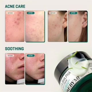 Kem dưỡng Some By Mi giảm mụn mờ thâm AHA-BHA-PHA 30 Days Miracle Cream Some By Mi 50ml