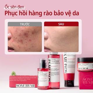 [SOME BY MI] Kem dưỡng Ốc sên Rau má Snail Truecica Miracle Repair Cream 50ml