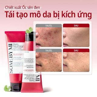 Sữa rửa mặt ốc sên Some By Mi Snail Truecica 100ml – Hỗ trợ phục hồi, làm dịu da tổn thương