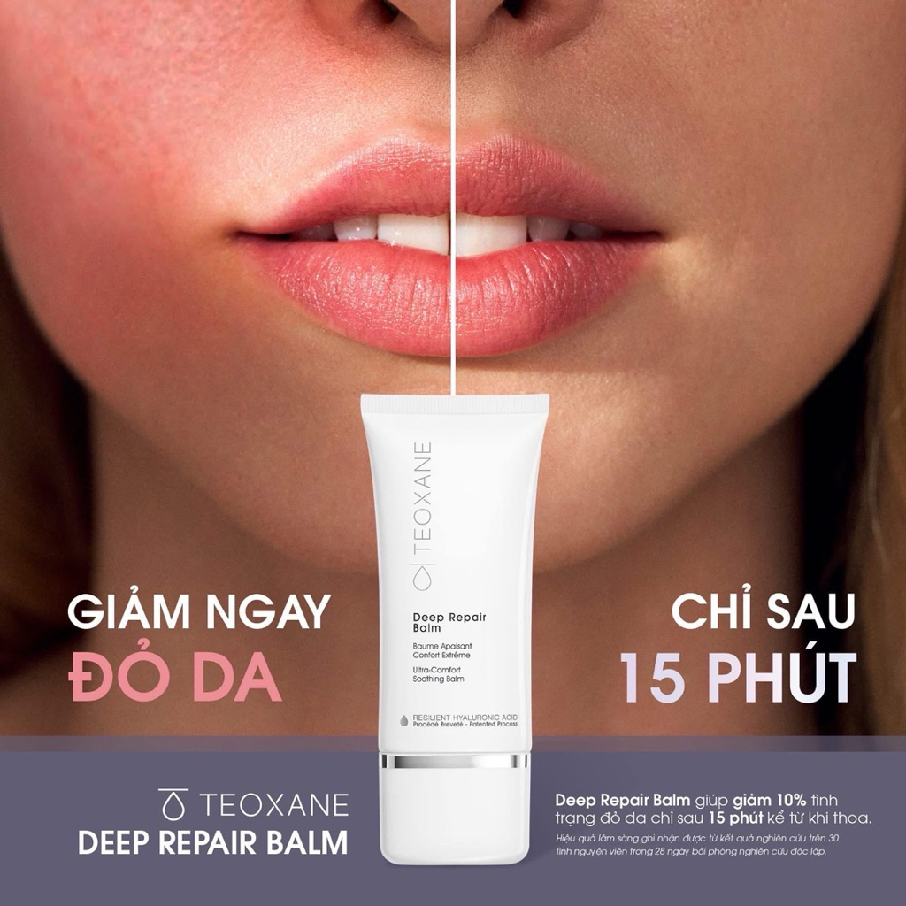 KEM DƯỠNG PHỤC HỒI DA TREATMENT TEOXANE DEEP REPAIR BALM