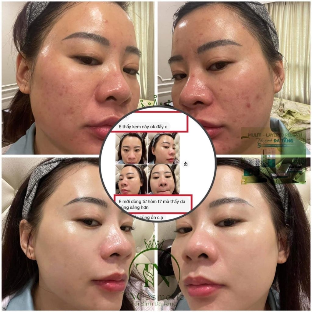 [MUA 1 TẶNG 10] Kem Dưỡng Da Tái Sinh Day 2 – Làm đều màu, giảm nám, tăng sinh collagen – Tặng 10 mặt nạ cao cấp