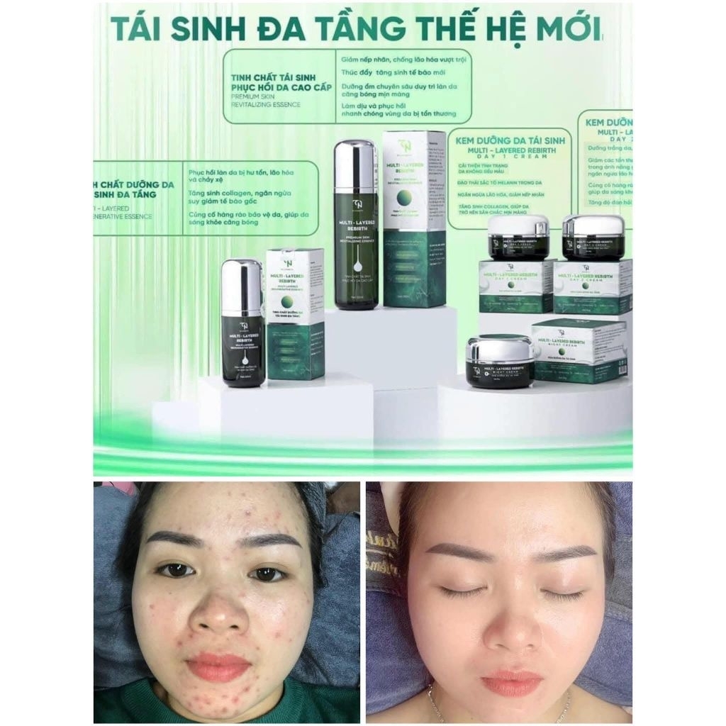 [MUA 1 TẶNG 10] Kem Dưỡng Da Tái Sinh Day 2 – Làm đều màu, giảm nám, tăng sinh collagen – Tặng 10 mặt nạ cao cấp