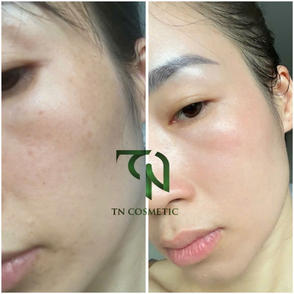 [MUA 1 TẶNG 10] Kem Dưỡng Da Tái Sinh Day 2 – Làm đều màu, giảm nám, tăng sinh collagen – Tặng 10 mặt nạ cao cấp
