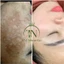 Tinh Chất Dưỡng Da Tái Sinh Đa Tầng 40ml – Phục hồi da hư tổn, ngừa lão hoá, căng bóng mịn màng