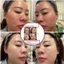 Tinh Chất Tái Sinh Đa Tầng 100ml – Phục Hồi Da Hư Tổn, Tăng Collagen, Căng Bóng Sáng Mịn