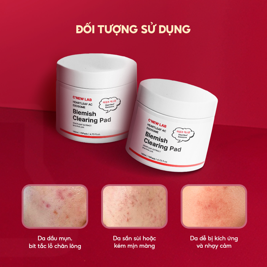 COMBO cho da dầu mụn: Toner Pad Exosome hộp 70 miếng và Serum Diếp cá 50ml