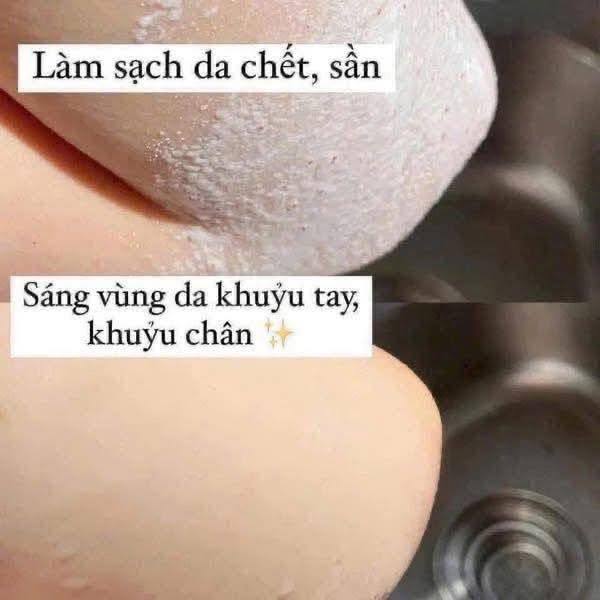 Tẩy da chết body Dove Mỹ 425g, tẩy tế bào chết body