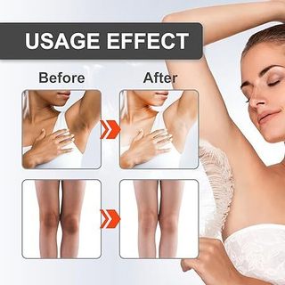 Kem Dưỡng Trắng Da MAYCHEER 80GR, Kem Giảm Thâm, Làm Trắng Da, Giảm Melanin Nách, Các Khớp Trong Đùi, Vân Thỏ Beauty