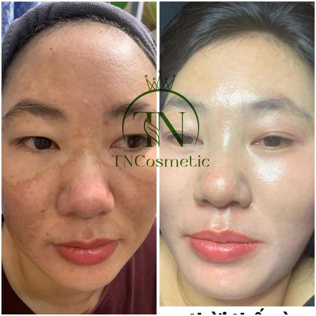 Serum Glutathione TN Cosmetic – Da sáng mịn bật tone – TẶNG 10 MẶT NẠ CAO CẤP 🎁