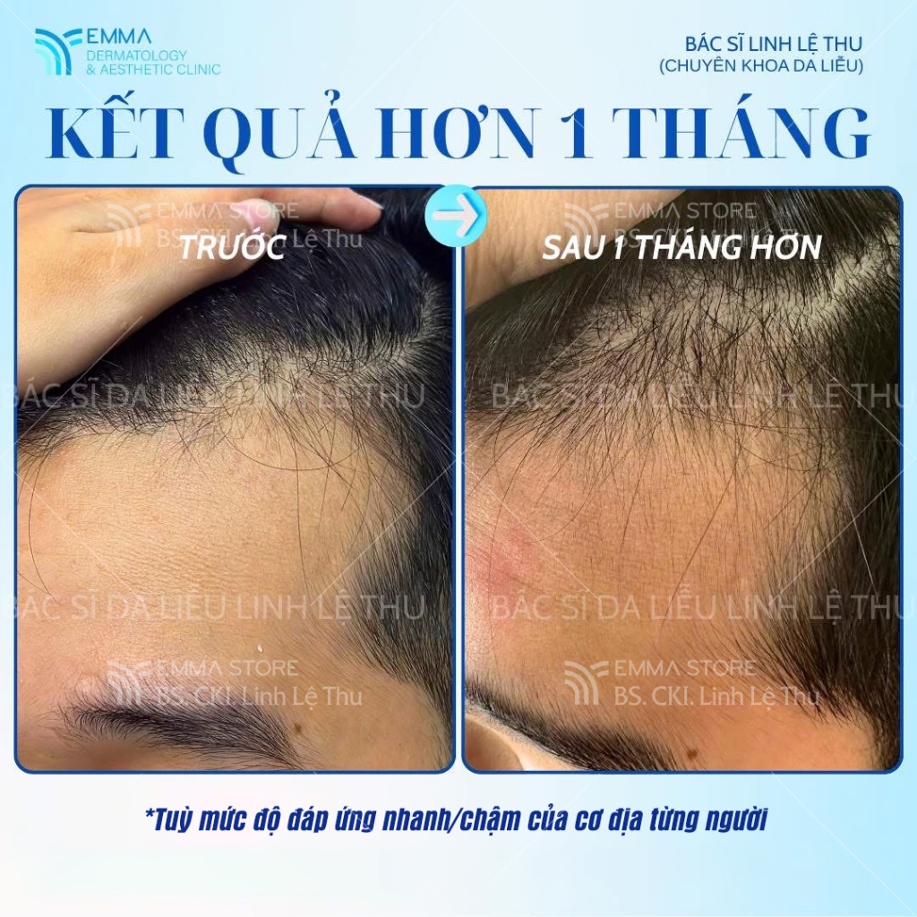 [Redenyl] Dầu Gội, Xịt Dưỡng Tóc Kích Thích Mọc Tóc, Giúp Tóc Chắc Khỏe, Ngăn Ngừa Rụng Tóc | BigBuy360 - bigbuy360.vn