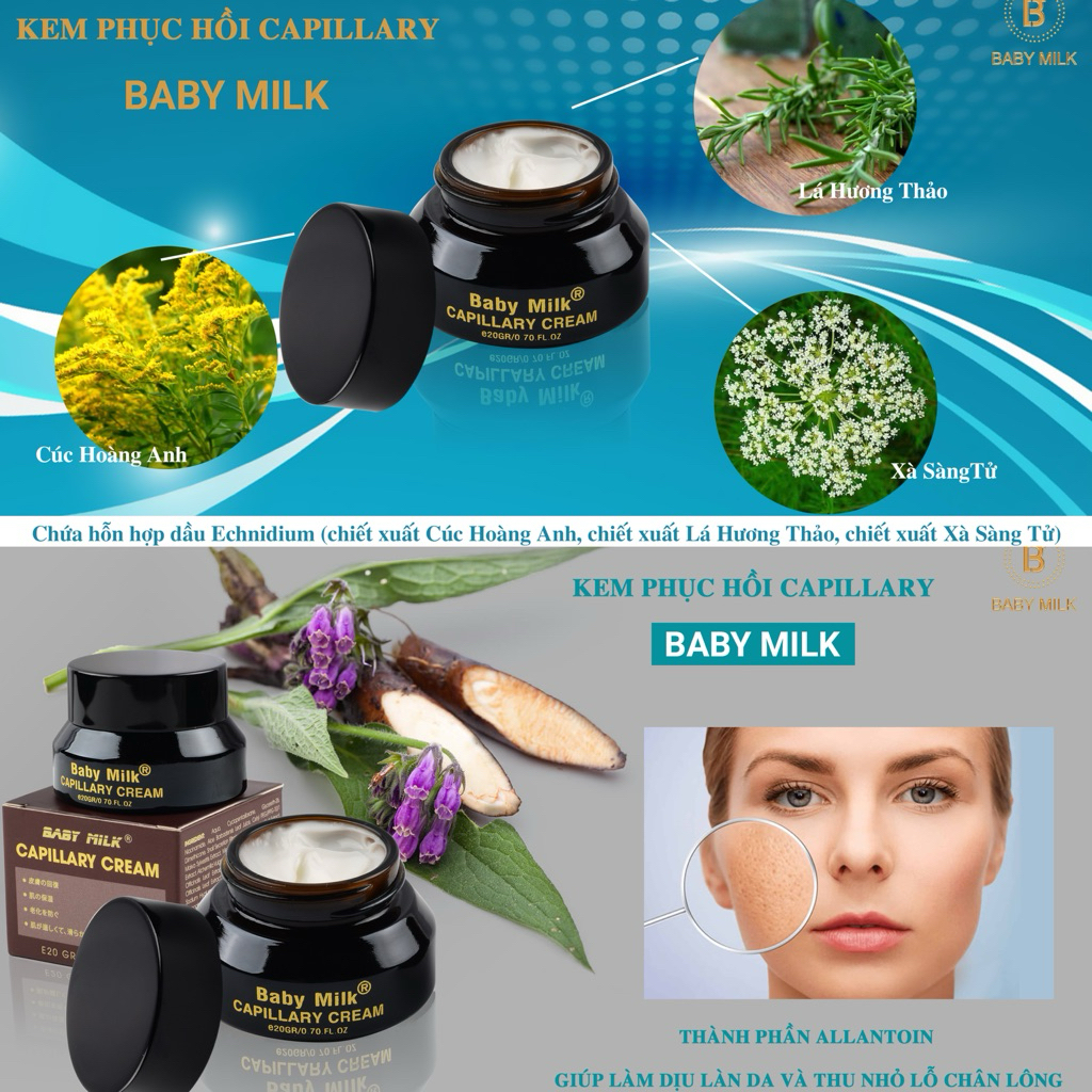 [Hot] Kem Mao Mạch Baby Milk Phục Hồi Da Mỏng Đỏ Nhiễm Corticoid 20g - Hàng Hiệu Cao Thiên Nhi