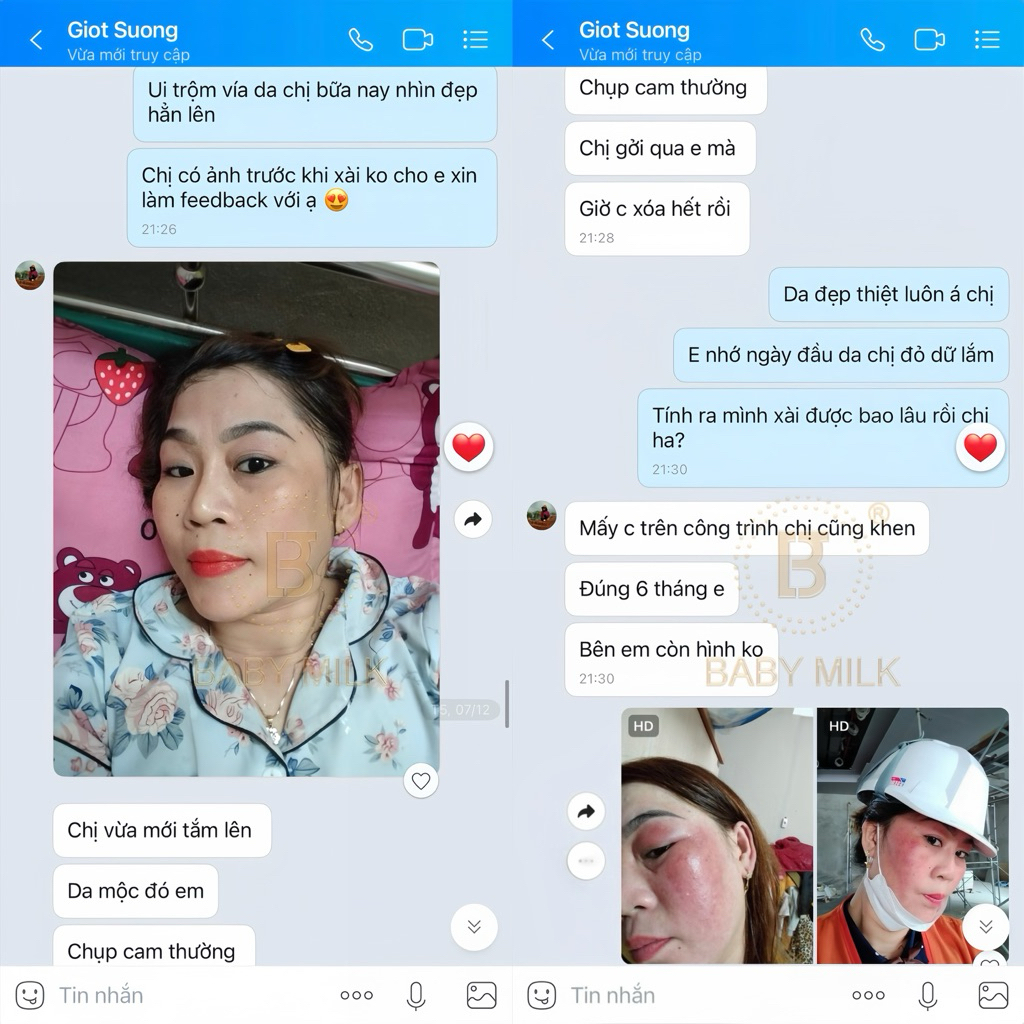 [Hot] Kem Mao Mạch Baby Milk Phục Hồi Da Mỏng Đỏ Nhiễm Corticoid 20g - Hàng Hiệu Cao Thiên Nhi